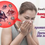 Алергия към прахови акари