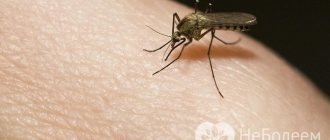 При повишена чувствителност на тялото ухапването на всяко насекомо може да причини не само значително подуване, но и други неприятни симптоми