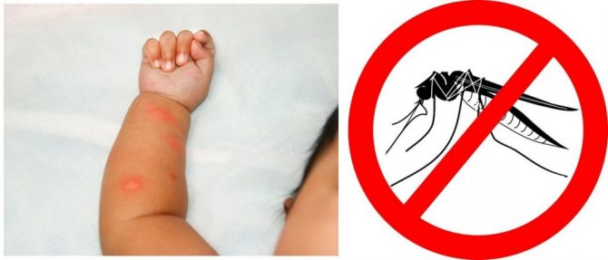 Спрете комарите